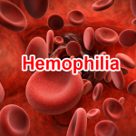 dich-vu/hemophilia/20220126_112007_517638_1.max-800x800.png