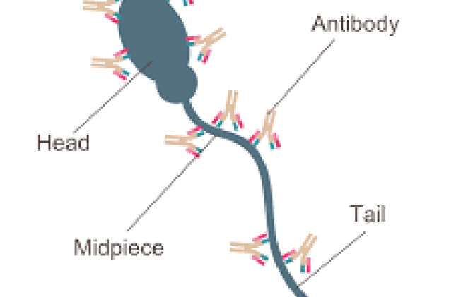 Xét nghiệm nam khoa - hỗ trợ bác sĩ chẩn đoán, điều trị hiếm muộn
