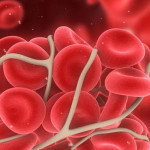 dich-vu/thrombophilia_banner-1024x521-150x150.jpg