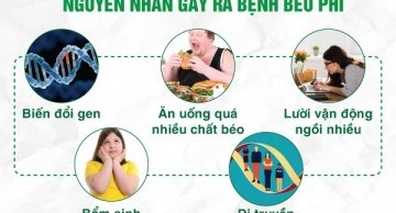 tin-chuyen-nganh/9.2020/mydna/nguyen-nhan-gay-beo-phi.jpg