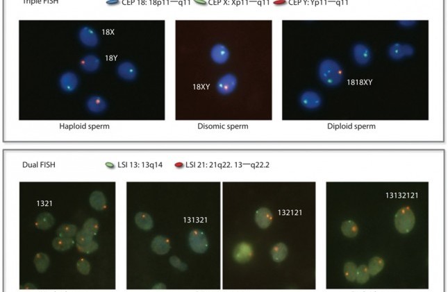 FISH - Xét nghiệm chẩn đoán lệch bội nhiễm sắc thể tinh trùng