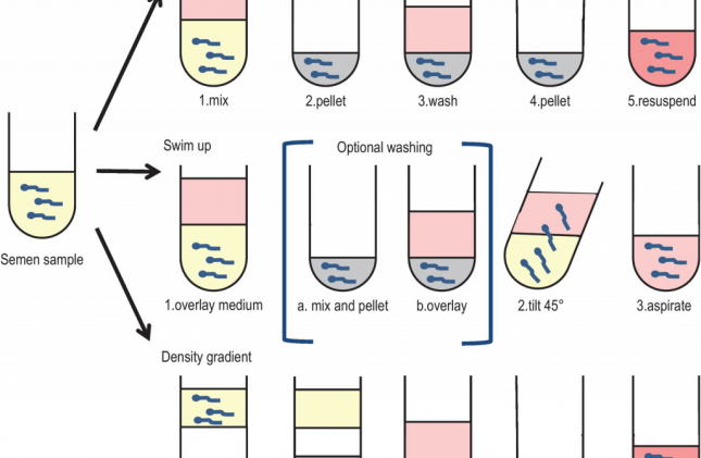 Các phương pháp chọn lựa tinh trùng