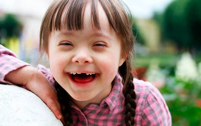 Down gây ra nhiều biến chứng nguy hiểm cho bé