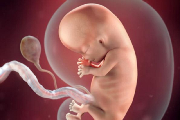 thai nhi bị dị tật ống thần kinh do di truyền