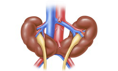 Dị tật thận móng ngựa