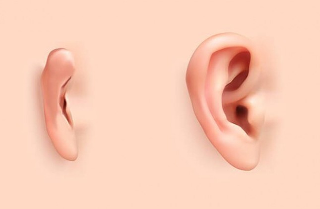 Nguyên nhân dị tật vành tai ở thai nhi