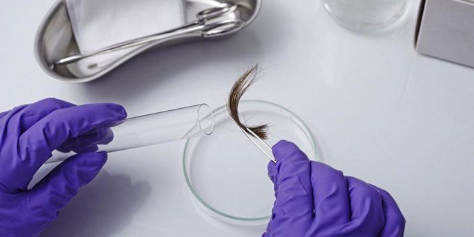 Thử ADN bằng mẫu t&oacute;c c&oacute; ch&acirc;n