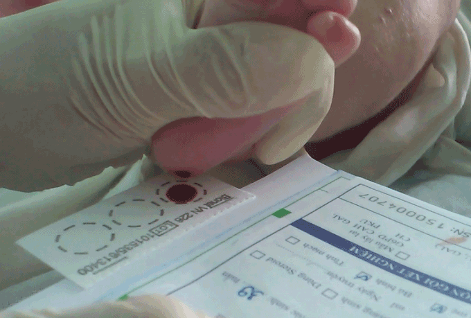 Thấm máu vào giấy FTA và để máu tự lan ra.