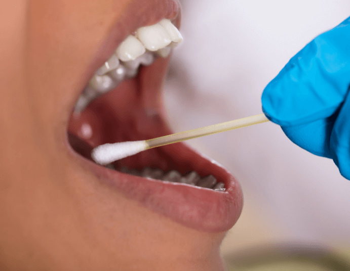 lấy mẫu niêm mạc miệng xét nghiệm adn