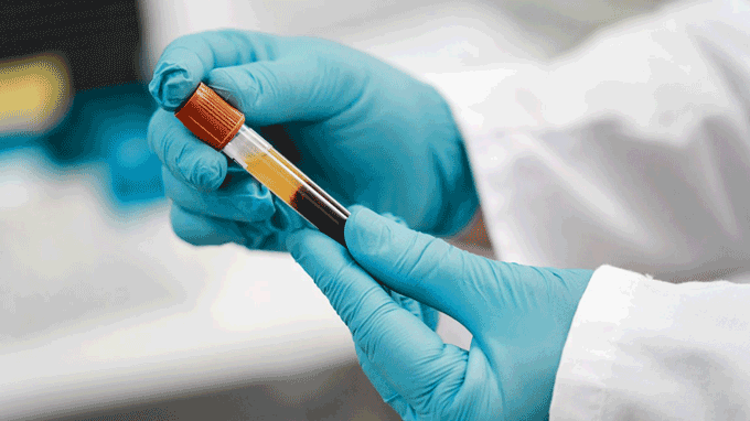 Mẫu máu xét nghiệm ADN ông - cháu