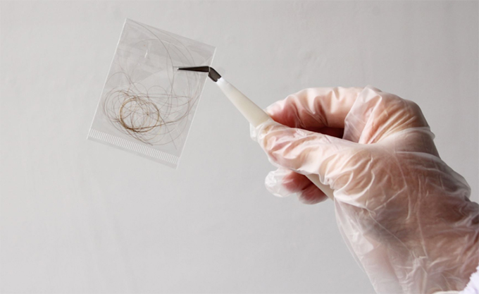 Xét nghiệm ADN bằng mẫu tóc có chân