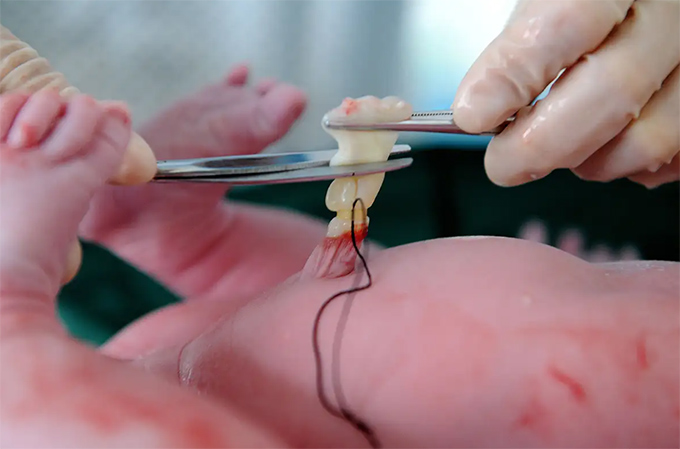 Có thể xét nghiệm ADN bằng mẫu cuống rốn
