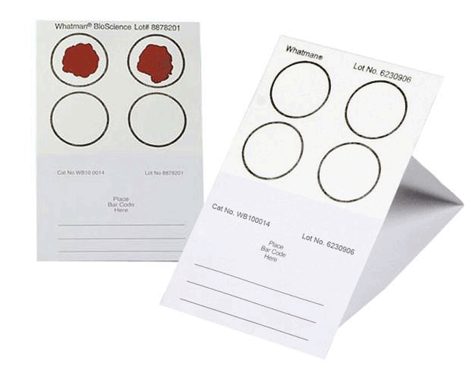 Thẻ thu mẫu máu chứa giấy FTA.