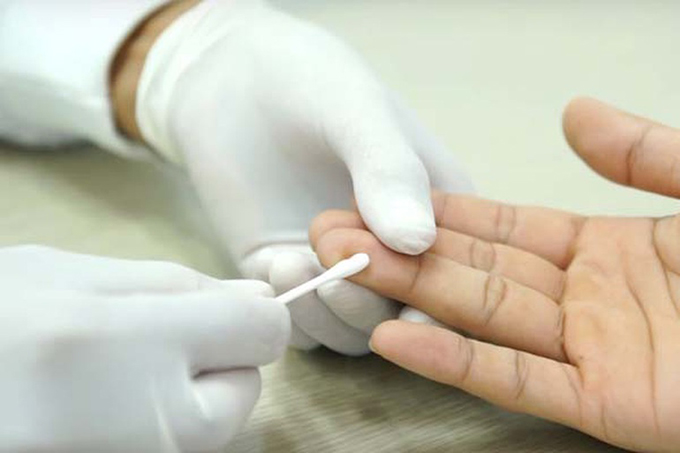 Mẫu máu xét nghiệm ADN