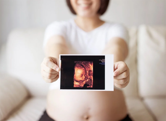 h&igrave;nh ảnh si&ecirc;u &acirc;m 4D