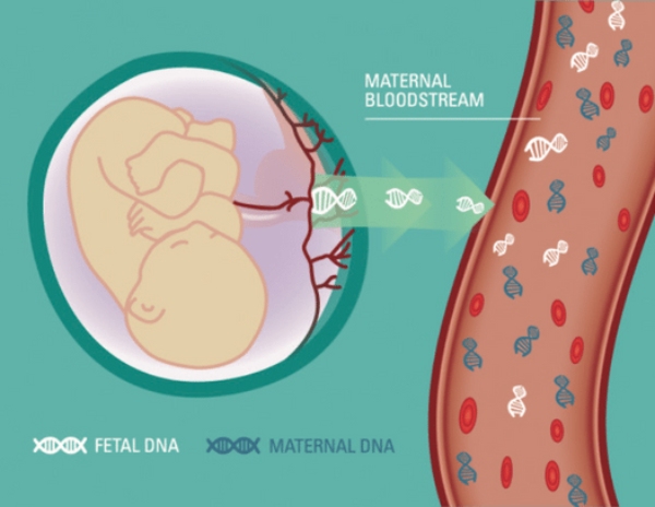 Phương pháp xét nghiệm NIPT có độ chính xác cao