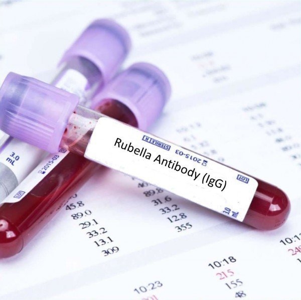 Xét nghiệm tìm kháng thể IgM, IgG Rubella