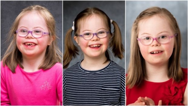 Hội chứng siêu nữ