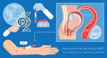 Xét nghiệm NIPT ở TPHCM