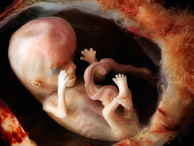 Xét nghiệm Double test có độ chính xác cao nhất khi mẹ thực hiện ở tuần 11 - 13